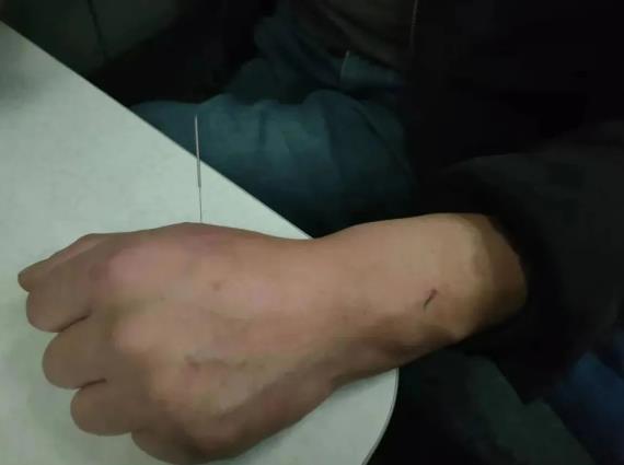 危急时刻敢出手，中医技术显风采